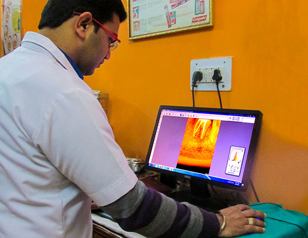 this is a Image of dr rishi saini working at saini dental clinic best dental clinic in jalandhar